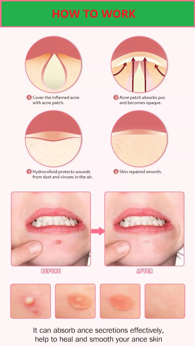 tea tree oil patch 3